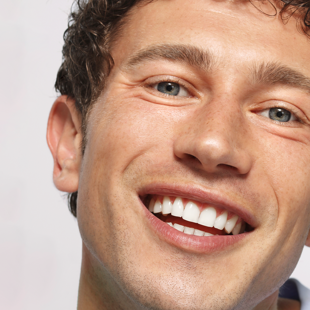 Aligner